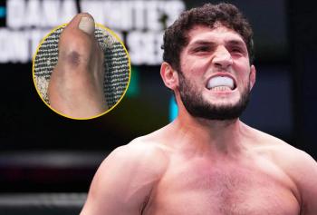 Ikram Aliskerov forfait pour l’UFC 318 après s’être fracturé le pied à l’approche du combat