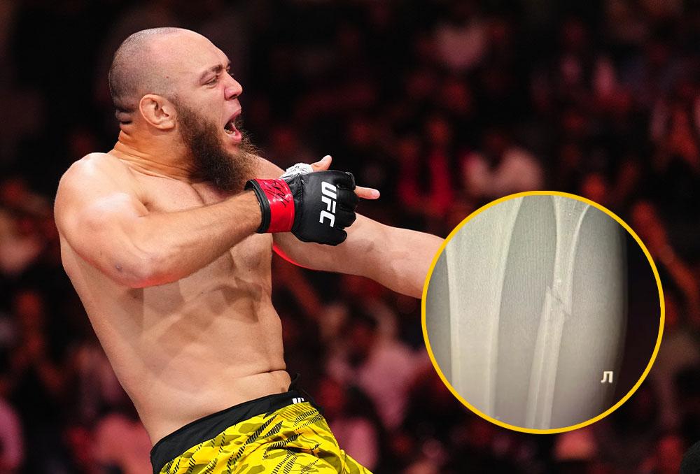 Valter Walker confirme sa blessure : le péroné est fissuré mais l'opération n'est pas nécessaire pour le moment