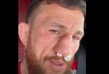 Merab Dvalishvili victime d’une sévère fracture du nez à l'entraînement après un coup de genou accidentel