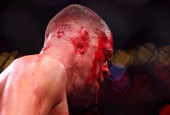 Arrêt de Nate Diaz : Les révélations de Jacob Duran sur les coulisses du carnage