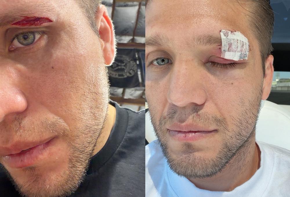 UFC 331 : Brian Ortega blessé, Renato Moicano déplacé au 31 octobre contre Tom Nolan