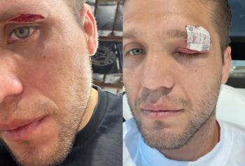 UFC 331 : Brian Ortega blessé, Renato Moicano déplacé au 31 octobre contre Tom Nolan