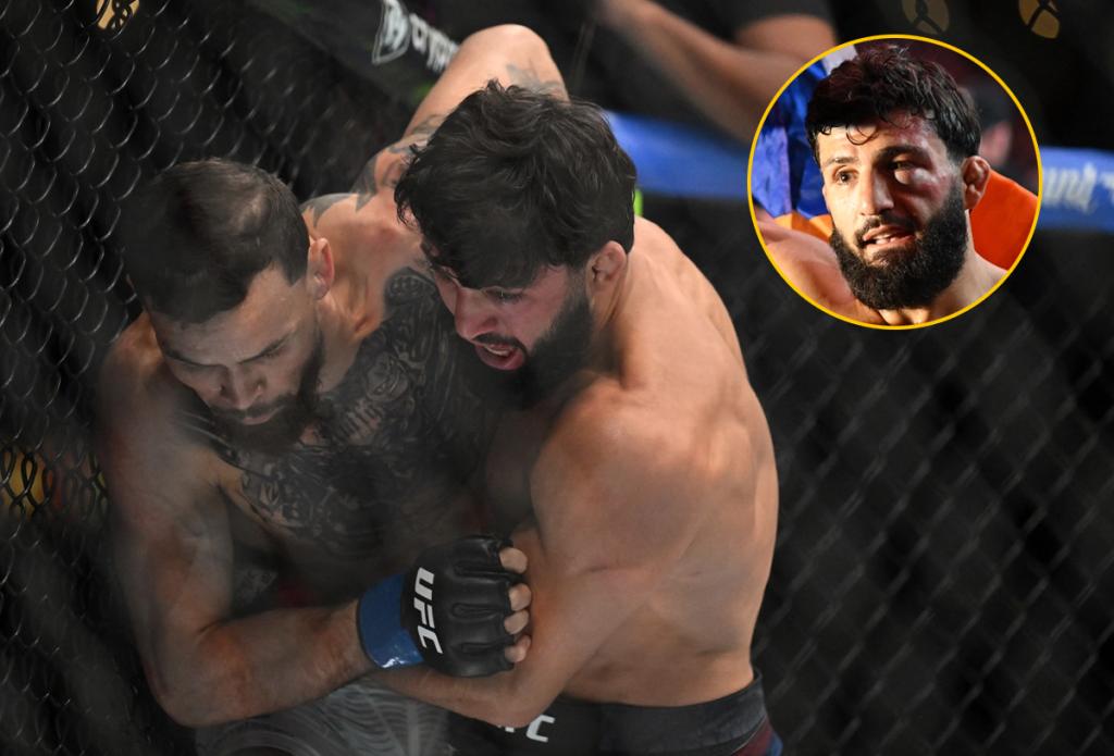 UFC 331 : Arman Tsarukyan prend la parole après sa victoire expéditive face à Mauricio Ruffy