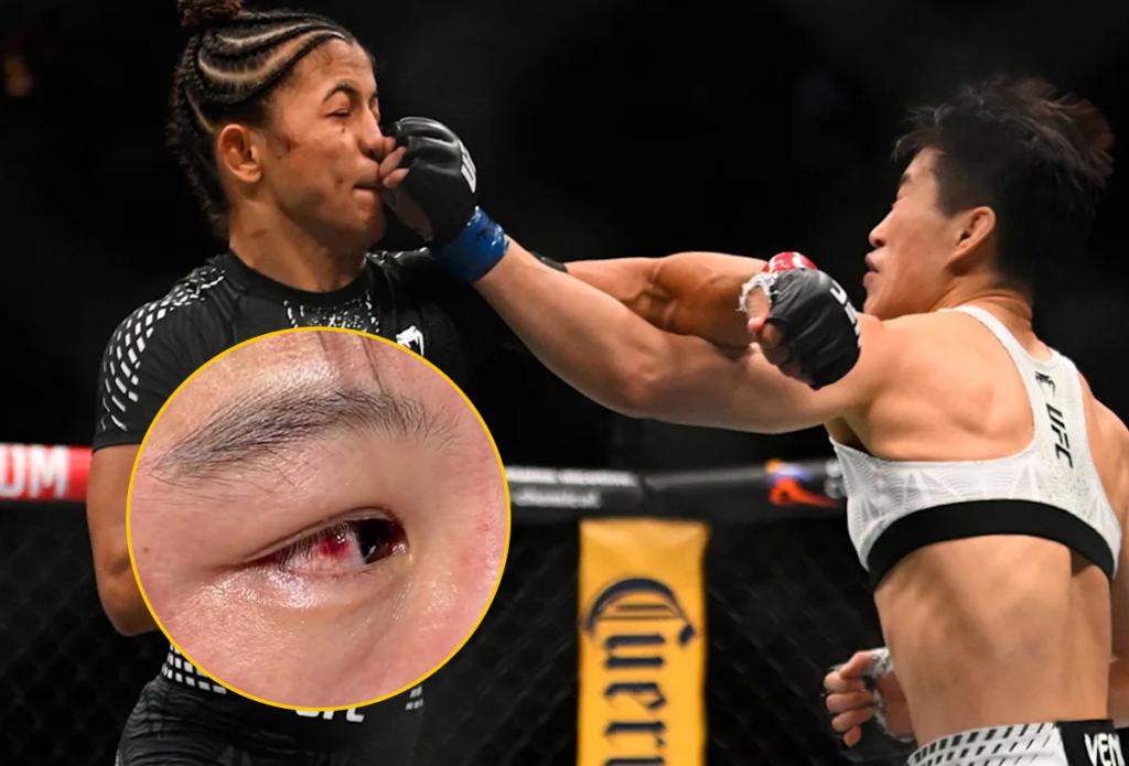 UFC 332 : Wang Cong dévoile la blessure à son œil après sa défaite pour le titre des poids mouches