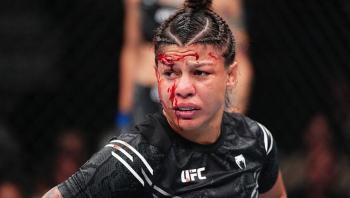 Mayra Bueno Silva publie une image de sa blessure | UFC 303