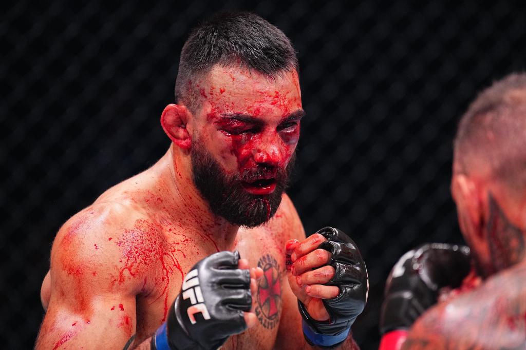 Benoit Saint-Denis s'exprime après sa terrible défaite à l'UFC Paris face à Renato Moicano