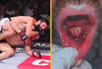 Robert Whittaker : une mâchoire brisée et des dents disloquées face à Khamzat Chimaev à l’UFC 308 | Abu Dhabi